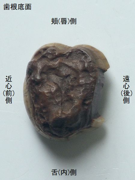 Cr-Br 咬合のルーツ Gnathology と対峙した石原咬合論・顆頭安定位と全運動軸/医歯薬出版株式会社